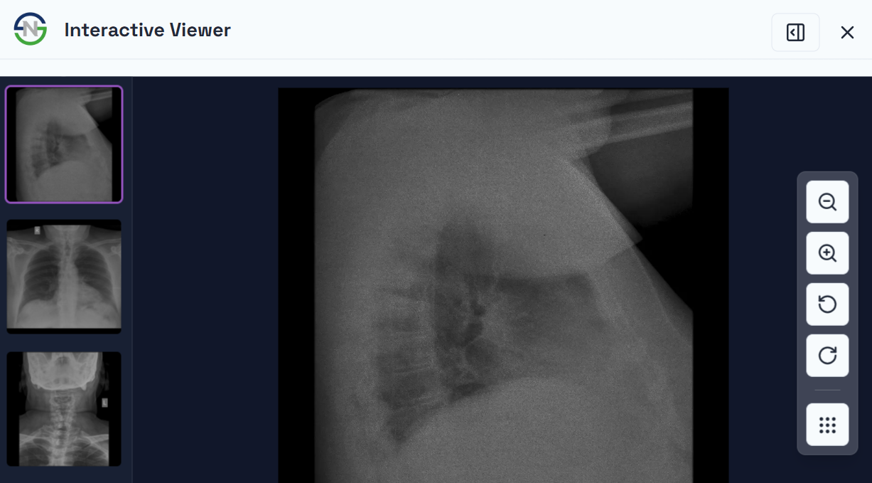 An interactive medical scan viewer showing annotations on a brain MRI.